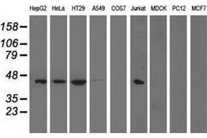 Western blot analysis of extracts (35 µg) from 9 different cell lines by using anti-PAICS monoclonal antibody. (PAICS anticorps)