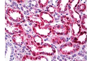 Anti-CLDN2 / Claudin 2 antibody IHC of human kidney, tubules.