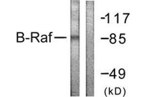 Western blot analysis of extracts from K562 cells, using B-RAF (Ab-601) Antibody. (SNRPE anticorps  (AA 576-625))