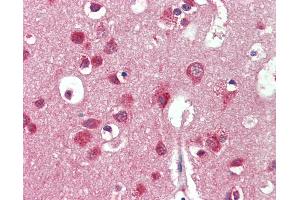 Anti-IDS antibody IHC staining of human brain, cortex.