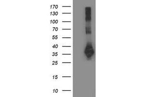 Western Blotting (WB) image for anti-Sirtuin 5 (SIRT5) antibody (ABIN1500928)