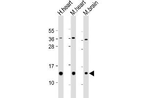 All lanes : Anti-NDUFB3 Antibody (Center) at 1:2000 dilution Lane 1: human heart lysate Lane 2: mouse heart lysate Lane 3: mouse brain lysate Lysates/proteins at 20 μg per lane.