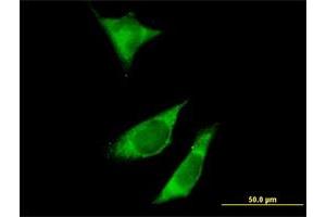 Immunofluorescence of purified MaxPab antibody to RPTOR on HeLa cell.