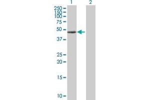 Western Blot analysis of PRKAR1A expression in transfected 293T cell line by PRKAR1A MaxPab polyclonal antibody.