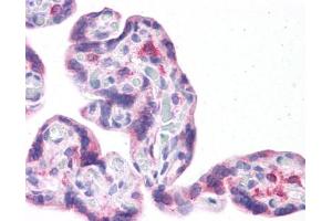 LRRC59 antibody was used for immunohistochemistry at a concentration of 4-8 ug/ml.