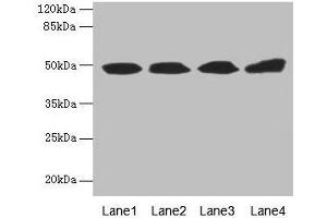 Western blot All lanes: TBCEL antibody at 12 μg/mL Lane 1: Rat gonadal tissue Lane 2: PC-3 whole cell lysate Lane 3: Rat heart tissue Lane 4: 293T whole cell lysate Secondary Goat polyclonal to rabbit IgG at 1/10000 dilution Predicted band size: 49 kDa Observed band size: 49 kDa (TBCEL anticorps  (AA 1-424))