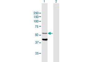 Western Blot analysis of CYP4F12 expression in transfected 293T cell line by CYP4F12 MaxPab polyclonal antibody.