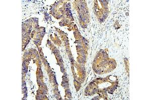 IHC analysis of GLI2 using anti-GLI2 antibody (ABIN6719569).