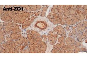 Immunohistochemistry (IHC) image for anti-Tight Junction Protein 1 (TJP1) (C-Term) antibody (ABIN6254231)