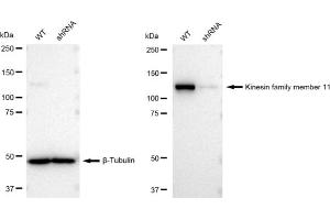Western blotting analysis using Kinesin family member 11 antibody (ABIN7799200). (Recombinant KIF11 anticorps)