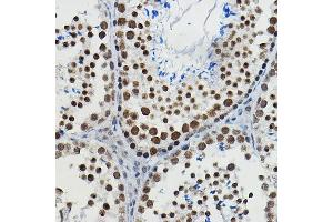 Immunohistochemistry of paraffin-embedded mouse testis using METTL14 Rabbit pAb (ABIN6131104, ABIN6143759, ABIN6143760 and ABIN6224625) at dilution of 1:100 (40x lens).