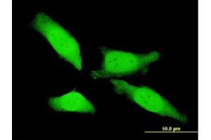 Immunofluorescence of monoclonal antibody to MTL5 on HeLa cell. (MTL5 anticorps  (AA 399-508))
