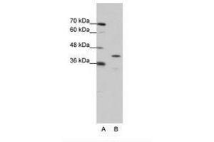 Image no. 1 for anti-Cytoplasmic Polyadenylation Element Binding Protein 2 (CPEB2) (AA 204-253) antibody (ABIN6736217) (CPEB2 anticorps  (AA 204-253))
