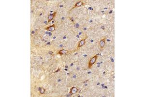 Immunohistochemical analysis of paraffin-embedded R. (CNR2 anticorps  (C-Term))