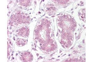 Anti-IKB Alpha antibody IHC of human breast. (NFKBIA anticorps  (AA 34-48))