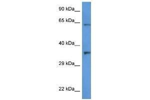 Western Blot showing CTSL2 antibody used at a concentration of 1 ug/ml against HT1080 Cell Lysate (Cathepsin L2 anticorps  (C-Term))