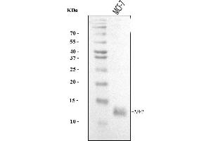 Western blot analysis of TFF1 using anti-TFF1 antibody (ABIN7602931).