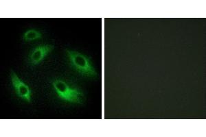 Peptide - +Immunofluorescence analysis of HeLa cells, using EPHB6 antibody. (EPH Receptor B6 anticorps)