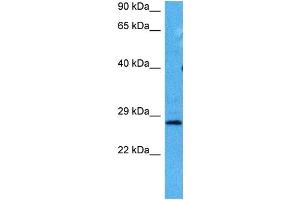 Host:  Mouse  Target Name:  HPRT1  Sample Tissue:  Mouse Testis  Antibody Dilution:  1ug/ml (HPRT1 anticorps  (Middle Region))