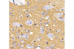 Immunohistochemistry analysis of paraffin-embedded mouse brain using,KCC2 (ABIN7075650) at dilution of 1: 1800 (KCC2 anticorps)