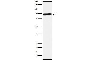 Western blot analysis of Calmegin expression in Jurkat cell lysate.