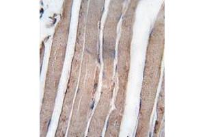 Formalin-fixed and paraffin-embedded human skeletal muscle tissue reacted with DAPK1 antibody (C-term) , which was peroxidase-conjugated to the secondary antibody, followed by DAB staining.