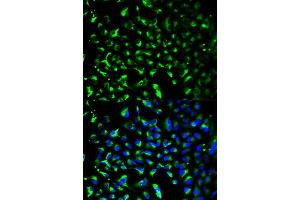 Immunofluorescence analysis of HeLa cell using PHB antibody. (Prohibitin anticorps)
