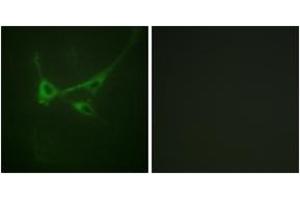 Immunofluorescence analysis of NIH-3T3 cells, using mTOR (Phospho-Ser2481) Antibody. (MTOR anticorps  (pSer2481))