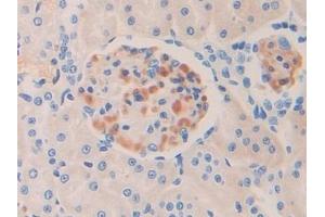 Detection of IL17RE in Rat Kidney Tissue using Polyclonal Antibody to Interleukin 17 Receptor E (IL17RE) (IL17RE anticorps  (AA 457-626))