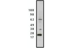 Image no. 1 for anti-SET Nuclear Oncogene (SET) antibody (ABIN793679) (SET/TAF-I anticorps)