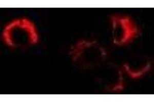 Immunofluorescent analysis of Sorbitol Dehydrogenase staining in MCF7 cells. (SORD anticorps)