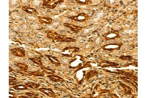 ABIN7094274 and ABIN7098321 at 1/100 staining Rat kidney tissue by IHC-P. (HERPUD2 anticorps  (N-Term))