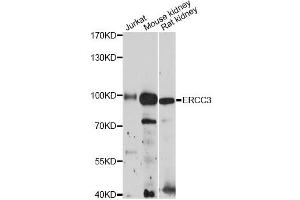 Western blot analysis of extracts of various cell lines, using ERCC3 antibody (ABIN6290288) at 1:3000 dilution. (ERCC3 anticorps)