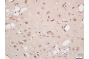 Formalin-fixed and paraffin embedded rat brain labeled with Rabbit Anti-B-Raf (Ser446) Polyclonal Antibody, Unconjugated (ABIN756787) at 1:200 followed by conjugation to the secondary antibody and DAB staining (SNRPE anticorps  (pSer446))