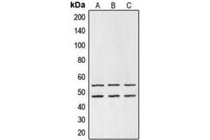 Western blot analysis of GSK3 alpha/beta expression in HEK293T (A), mouse liver (B), PC12 (C) whole cell lysates.