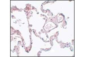 Immunohistochemistry of PLEKHM1 in human lung tissue with this product at 5 μg/ml. (PLEKHM1 anticorps  (N-Term))