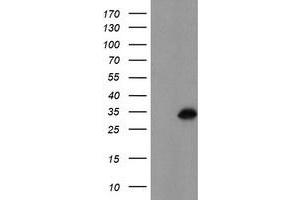 Western Blotting (WB) image for anti-Myeloid Leukemia Factor 1 (MLF1) antibody (ABIN1499495) (MLF1 anticorps)