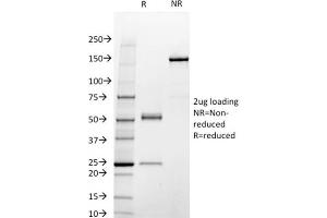 SDS-PAGE Analysis Purified STAT3 Mouse Monoclonal Antibody (STAT3/2409).