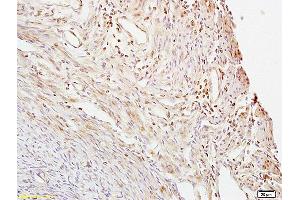 Formalin-fixed and paraffin embedded mouse uterus labeled with Anti- CTBP1 Polyclonal Antibody, Unconjugated (ABIN686152) at 1:200 followed by conjugation to the secondary antibody and DAB staining. (CTBP1 anticorps  (AA 351-440))