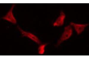 ABIN6266626 staining RAW264. (Presenilin 1 anticorps  (Internal Region))
