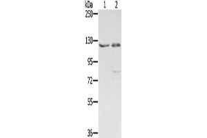 Gel: 6 % SDS-PAGE, Lysate: 40 μg, Lane 1-2: 293T cells, hela cells, Primary antibody: ABIN7192565(SMC6 Antibody) at dilution 1/400, Secondary antibody: Goat anti rabbit IgG at 1/8000 dilution, Exposure time: 1 minute (SMC6 anticorps)