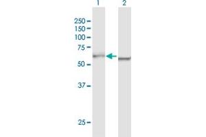 Western Blot analysis of DDX5 expression in transfected 293T cell line by DDX5 MaxPab polyclonal antibody. (DDX5 anticorps  (AA 1-614))