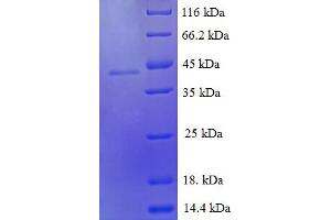SDS-PAGE (SDS) image for Growth Differentiation Factor 9 (GDF9) (AA 320-454) protein (GST tag) (ABIN5709565)