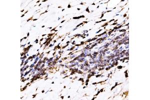 IHC analysis of EVL using anti-EVL antibody (ABIN7600986). (EVL anticorps  (AA 268-400))