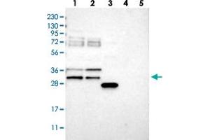 Western blot analysis of Lane 1: RT-4, Lane 2: U-251 MG, Lane 3: Human Plasma, Lane 4: Liver, Lane 5: Tonsil with RBM7 polyclonal antibody  at 1:250-1:500 dilution. (RBM7 anticorps)