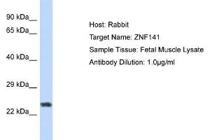 Host: Rabbit Target Name: ZNF732 Sample Tissue: Human Fetal Muscle Antibody Dilution: 1ug/ml (ZNF141 anticorps  (N-Term))