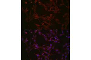 Immunofluorescence analysis of PC-12 cells using NPHP1 Rabbit pAb (ABIN6128349, ABIN6144768, ABIN6144769 and ABIN6222377) at dilution of 1:50 (40x lens).