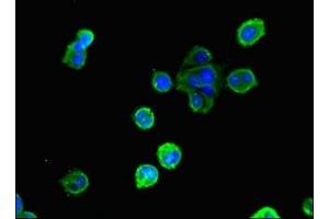 Immunofluorescent analysis of MCF-7 cells using ABIN7154080 at dilution of 1:100 and Alexa Fluor 488-congugated AffiniPure Goat Anti-Rabbit IgG(H+L)