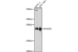Western blot analysis of extracts of various cell lines, using DN antibody (ABIN3016214, ABIN3016215, ABIN3016216, ABIN1679557 and ABIN6219627) at 1:1000 dilution.