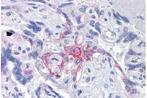 Anti-BUB1B / BubR1 antibody IHC staining of human placenta. (BUB1B anticorps  (AA 1-130))